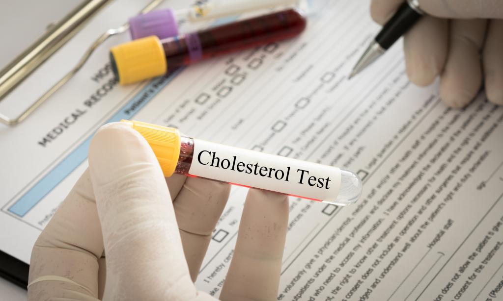 анализ крови на холестерин